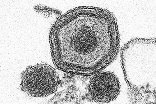 Elektronenmikroskopische Aufnahme des Virus der Afrikanischen Schweinepest Elektronenmikroskopische Aufnahme des Virus der Afrikanischen Schweinepest