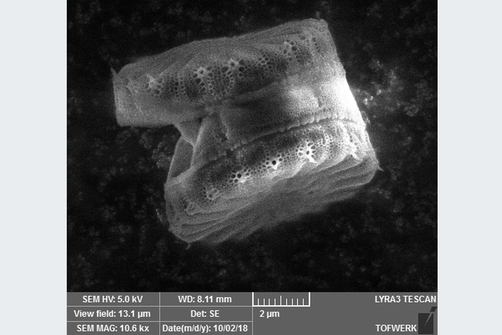 Automatisierte Einzelalgenanalytik von Cyclotella meneghinianamittels ICP-MS Automatisierte Einzelalgenanalytik von Cyclotella meneghinianamittels ICP-MS