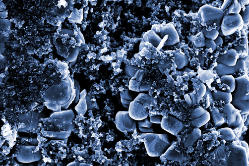 Scanning electron microscope image of the positive electrode of a lithium-ion cell. The smaller carbon nanoparticles are intended to improve conductivity. Scanning electron microscope image of the positive electrode of a lithium-ion cell. The smaller carbon nanoparticles are intended to improve conductivity.