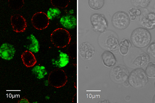 Left: Confocal Laser Scanning Microscopy images of living, specifically fluorophore-labelled hybridoma cells. Right: The same hybridoma cells in a light microscope.