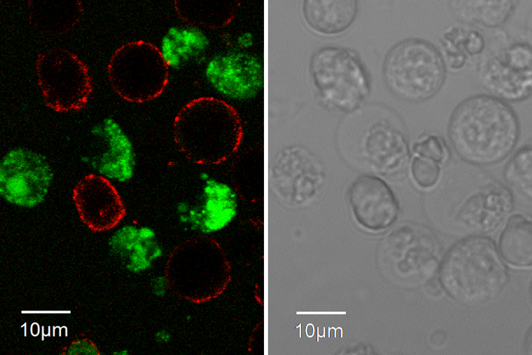 Left: Confocal Laser Scanning Microscopy images of living, specifically fluorophore-labelled hybridoma cells. Right: The same hybridoma cells in a light microscope.