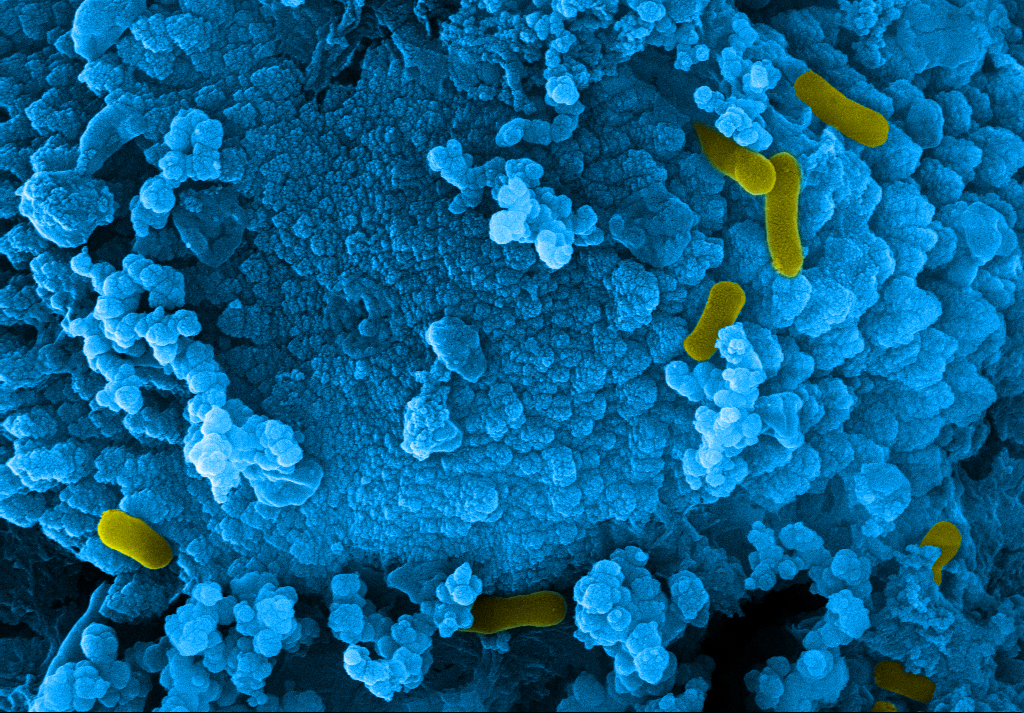 Microbiologically influenced corrosion affects all materials. BAM's research is interdisciplinary and embedded in a global network. Microbiologically influenced corrosion affects all materials. BAM's research is interdisciplinary and embedded in a global network.
