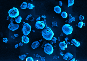 Particles of polyethylene terephthalate (PET), about one hundredth of a millimetre in size  Particles of polyethylene terephthalate (PET), about one hundredth of a millimetre in size