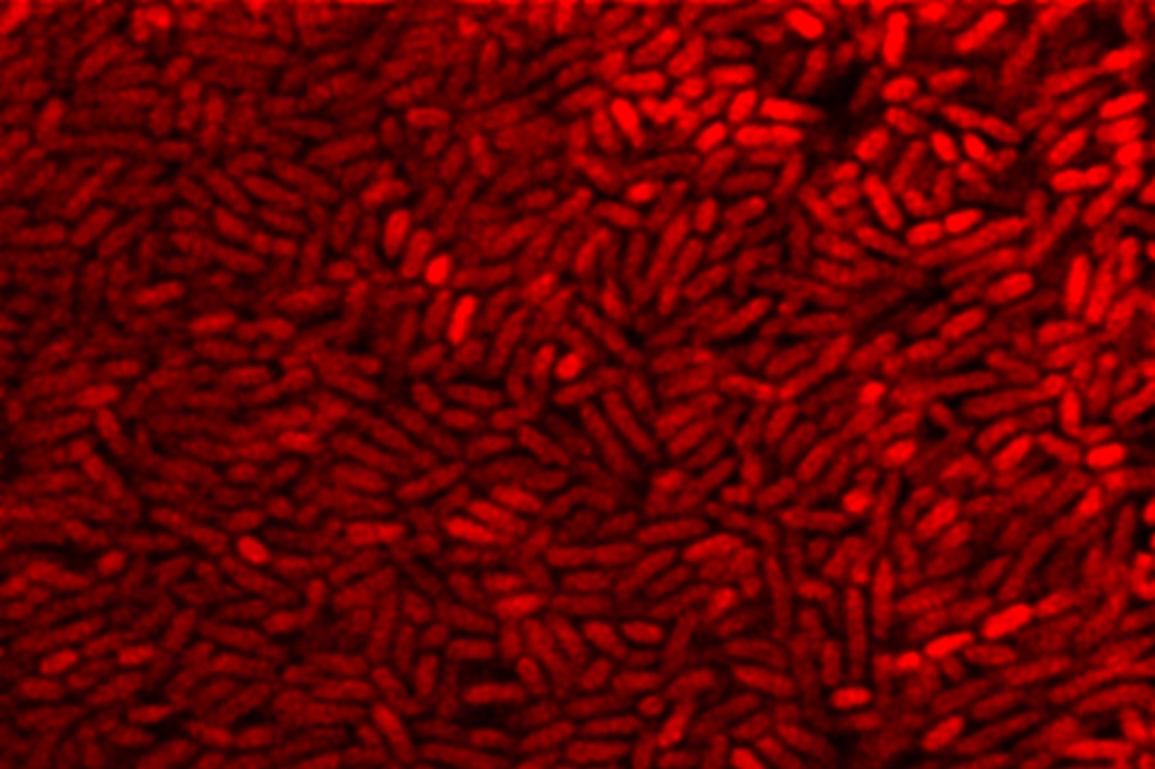 Pseudomonas aeruginosa cells Pseudomonas aeruginosa cells densely packed in a biofilm
